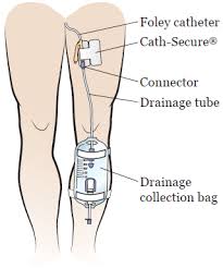 img-foley-catheter-care-1.jpe